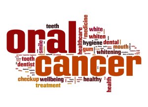 Vector image for Oral cancer and related words and search terms