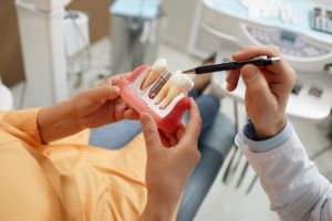 Image of Dental Implant