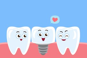 Two teeth and a dental implant